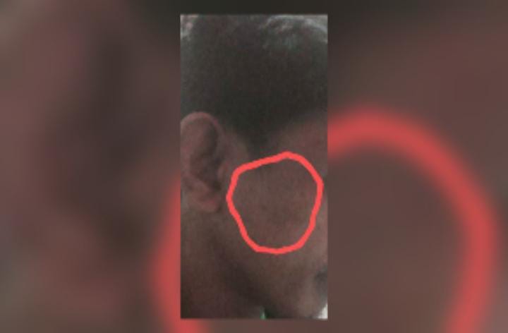 ASR, terduga korban pemerasan. (Dok: Satry/SimpulRakyat.co.id).